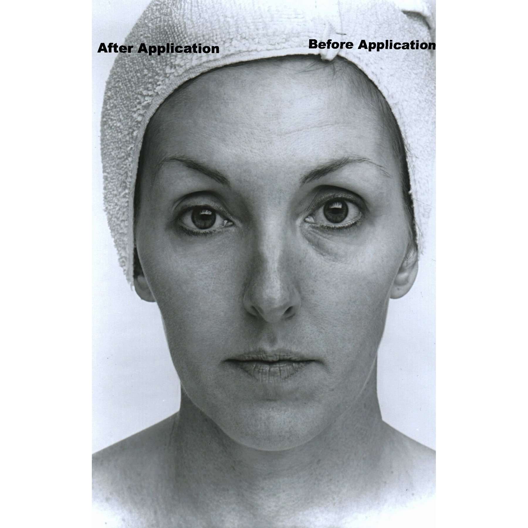Collagen Lifting Facial Kit With Marli's EDA Revitalizing Moisturizer